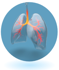 Asthma is a long-term condition that can lead to inflamed airways